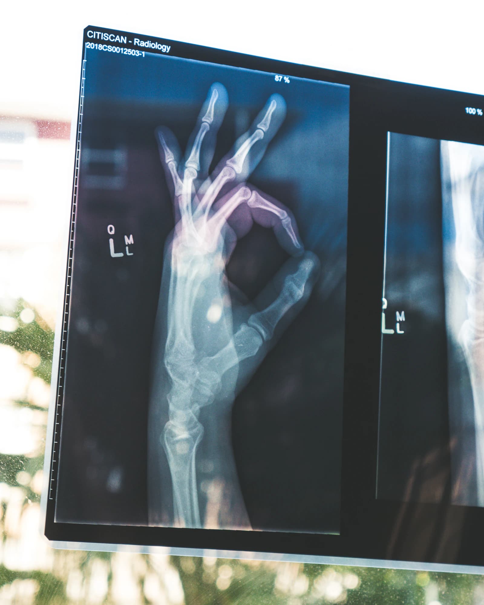 MRI scan van hersenen op een werkstation, met 3D weergave